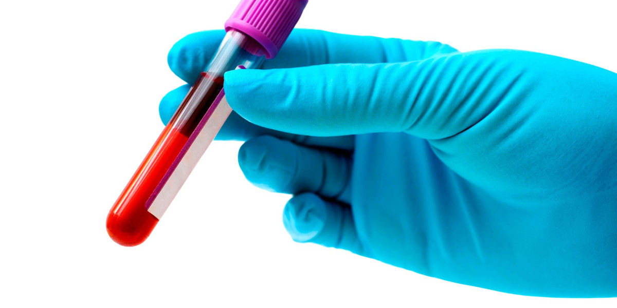 Understanding Blood Tests: A Comprehensive Guide for Pet Owners Safari Veterinary Care Centers